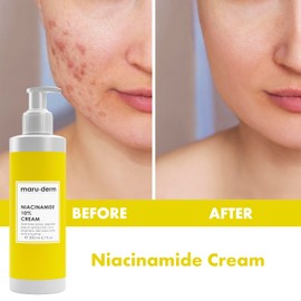maru.derm Niacinamid%10 Aufhellende und porenstraffende Creme, parabenfrei, SLS-frei, reduziert Porenbildung, reguliert die Talgproduktion, 200 ml