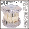 Dental Model, Dental Model, Implant Bridge Dental Dental Research Description