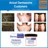 Dermasolve Psoriasis Complete Body & Scalp Kit