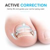 Toenail Correction Set, Straight & Curved Nail Clips for Ingrown