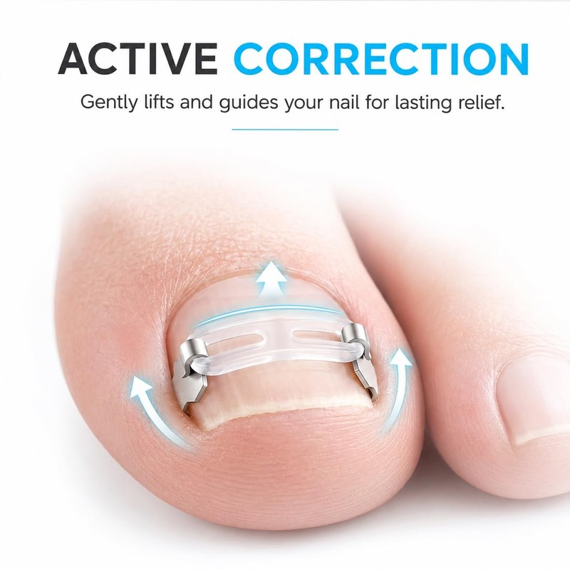 Toenail Correction Set, Straight & Curved Nail Clips for Ingrown