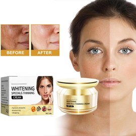 Aufhellungs-und Sommersprossenentfernungscreme, Gesichtsserum zur Korrektur dunkler Flecken, Pigmentation Removal Cream for Face and Body, Hautaufhellende und feuchtigkeitsspendende Toning-Creme