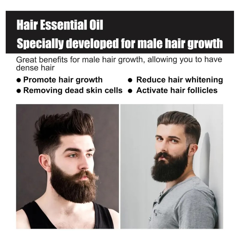 Sérum Para Engrosar El Cabello Para Hombres Y Crecimiento De