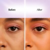 SheClear™ Jelly Glow Boosters - Under Eye Patches + Lip