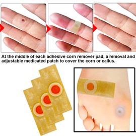 Reppkyh 24 Pieces Corn Removers for Feet, Corn Removers for Toe, Foot Corn-Toe Corn-Callus Removal, Corn Remover Feet