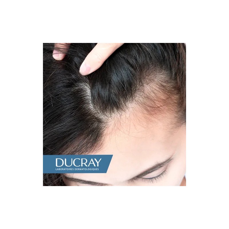 Loción Antí-caída Cabello Ducray Creastim Reactiv Gotero 60ml