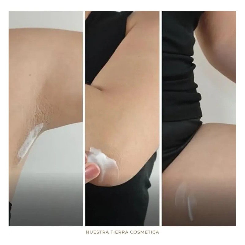 Crema Despigmentante Para Zonas Intimas Con Arbutina 100ml