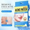 Anifer 36 Pcs Salicylic Acid Acne Patch - Hides Facial