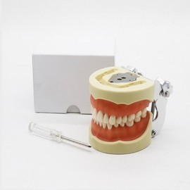 DentiForm 덴티폼 모형 위생사 재료상 모양 임플란트 기공사 입모형 [3배 크리스털 임플란트 모델] DentiForm Model Hygiene Material Shape Implant Technician Mold [3x Crystal Implant Model]