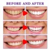 Nuevo Blanquea Los Dientes Y Corrige La Pasta De Dientes