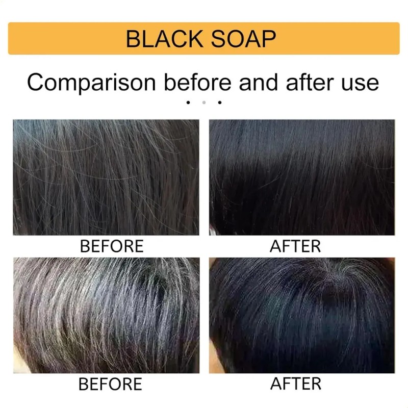 Champú Para Revertir Las Canas - Jabón Negro Especial