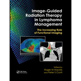 Image-Guided Radiation Therapy in Lymphoma Management: The Increasing Role of Functional Imaging
