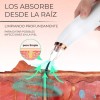 EGTMA Limpiador Y Extractor De Poros Y Espinillas Por Succión