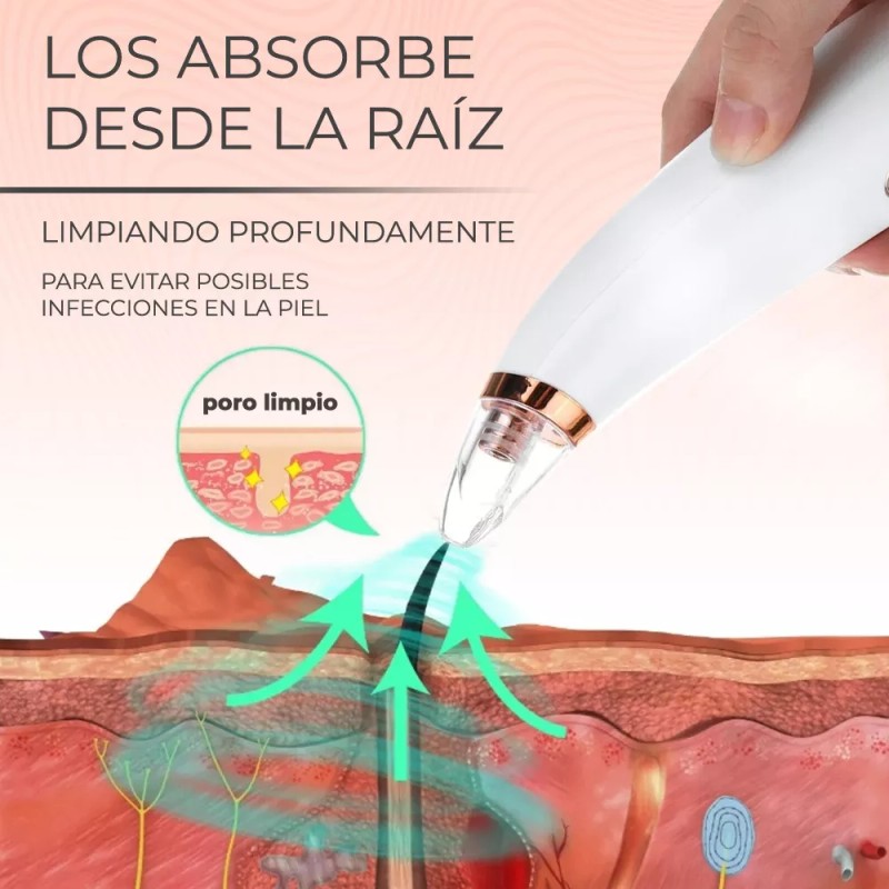 EGTMA Limpiador Y Extractor De Poros Y Espinillas Por Succión