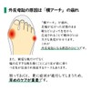 Foot Care Goods.COM Healthy Insole for Bunions, Supports Lateral Arch
