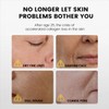 Deep Collagen Volufiline Serum with Niacinamide, 45ml