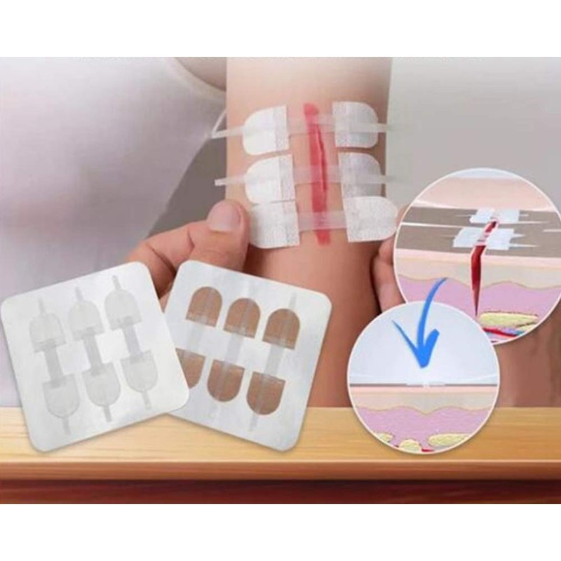 Emergency Wound Closures Adhesive Bandages, Zip Stitch Stickers for Camping,