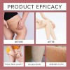 Crema Para Hinchazón De Piernas Y Pies Edema 20g