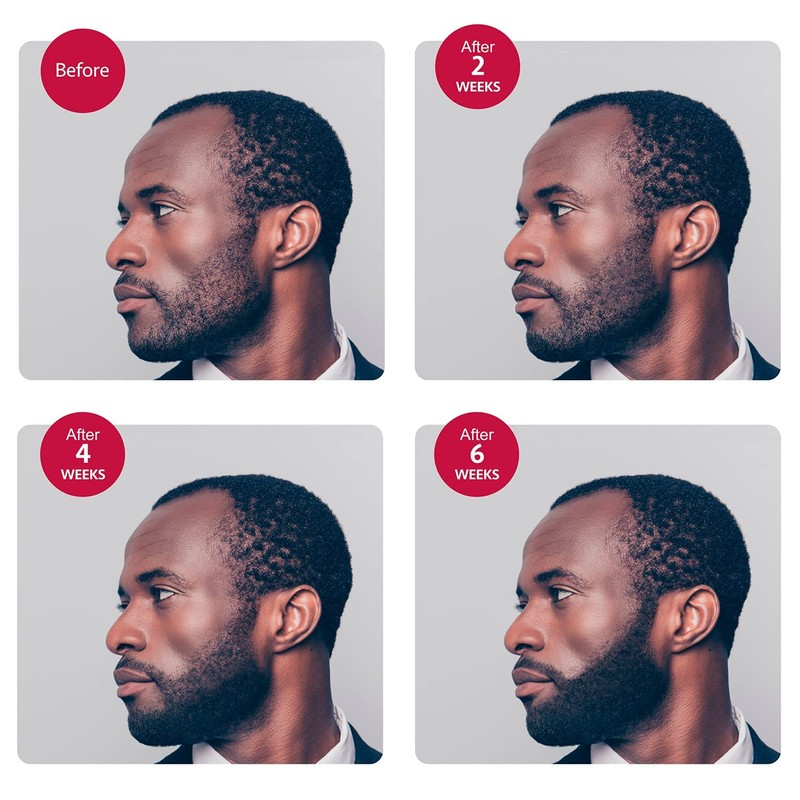 Godefroy - Suero para crecimiento de barba y bigote (15