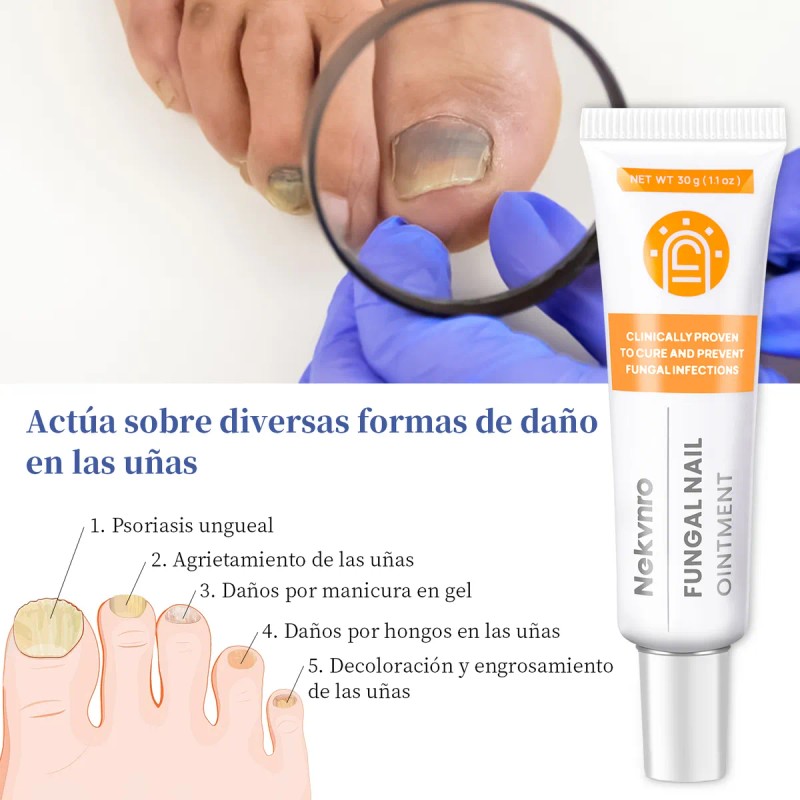 Pomada Antifúngica Para Uñas 30g,tratamiento Contra Hongos