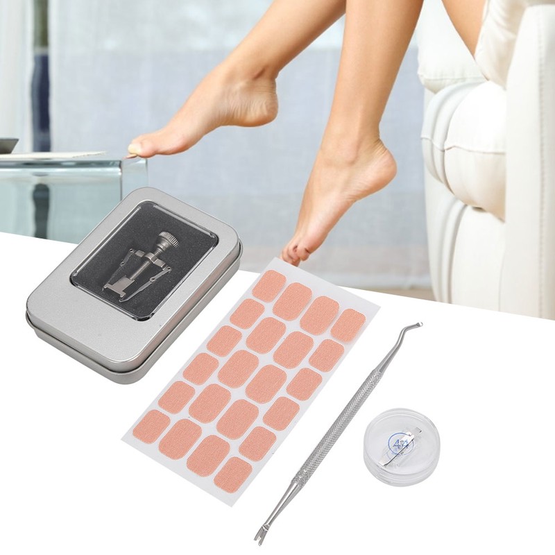 Ingrown Toenail Correction Patch Ingrown Nail Corrector Nail Insert Buckle
