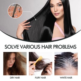 PP405 Hair Treatment | SCU-405 | Hair Growth Oil | Anti-Hair Loss | Quickly Absorbed & Non-Greasy | Hair Serum Growth for All Types | 2.11 FL.OZ / 60ML (1)