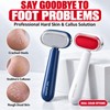 Pack of 2 Callus Remover for the Feet, Double-Sided Callus