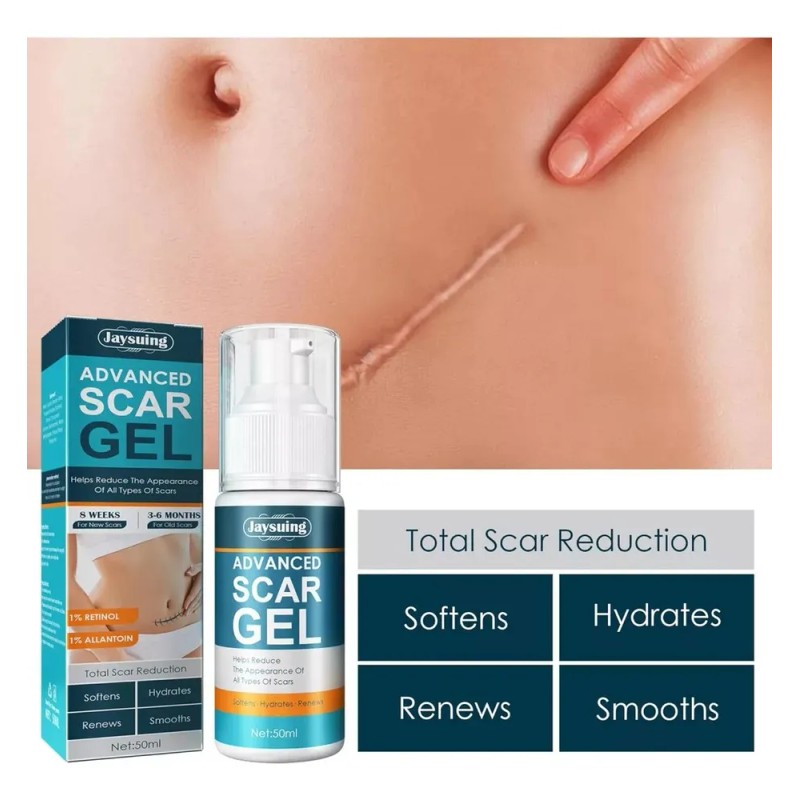 Crema Gel Reparadora Cicatrices Acné Jaysuing 50 Ml Estrías