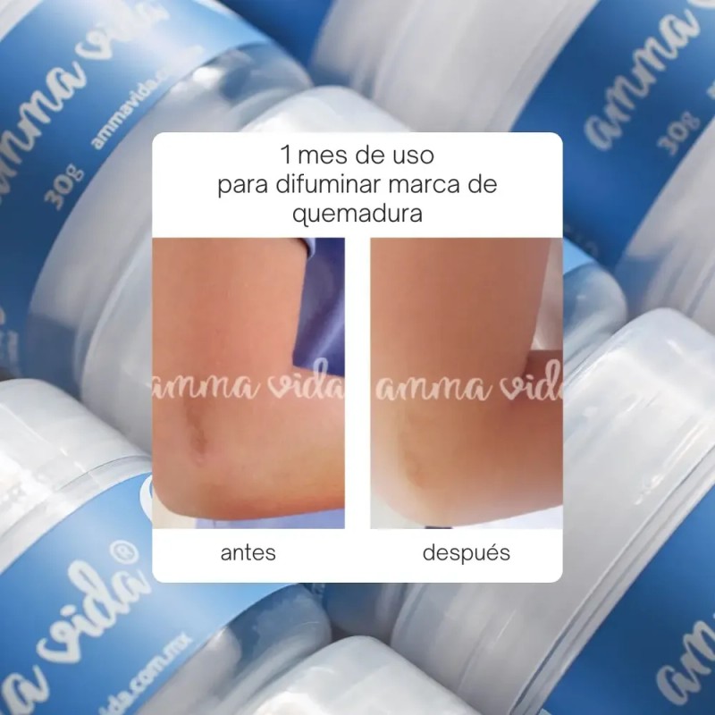 Crema Anti Manchas Amma Vida