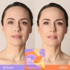 AngelicMisto Parches de Silicona Reutilizables para Ojos, Cara y Frente