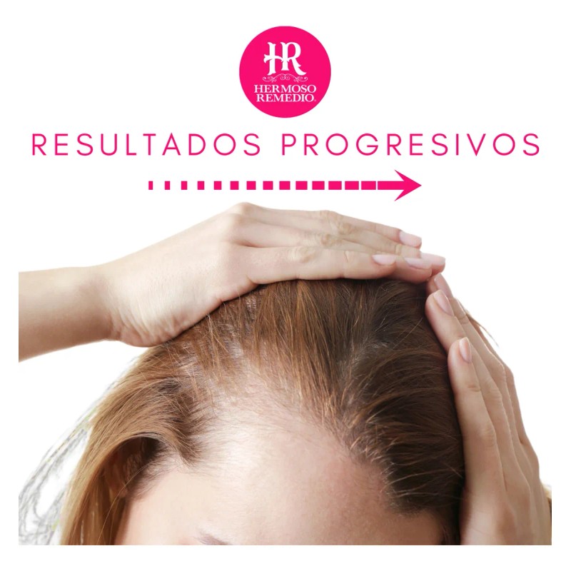 2 Shampoo Anticaida Crecimiento Acelerado Hidratante 7 En 1