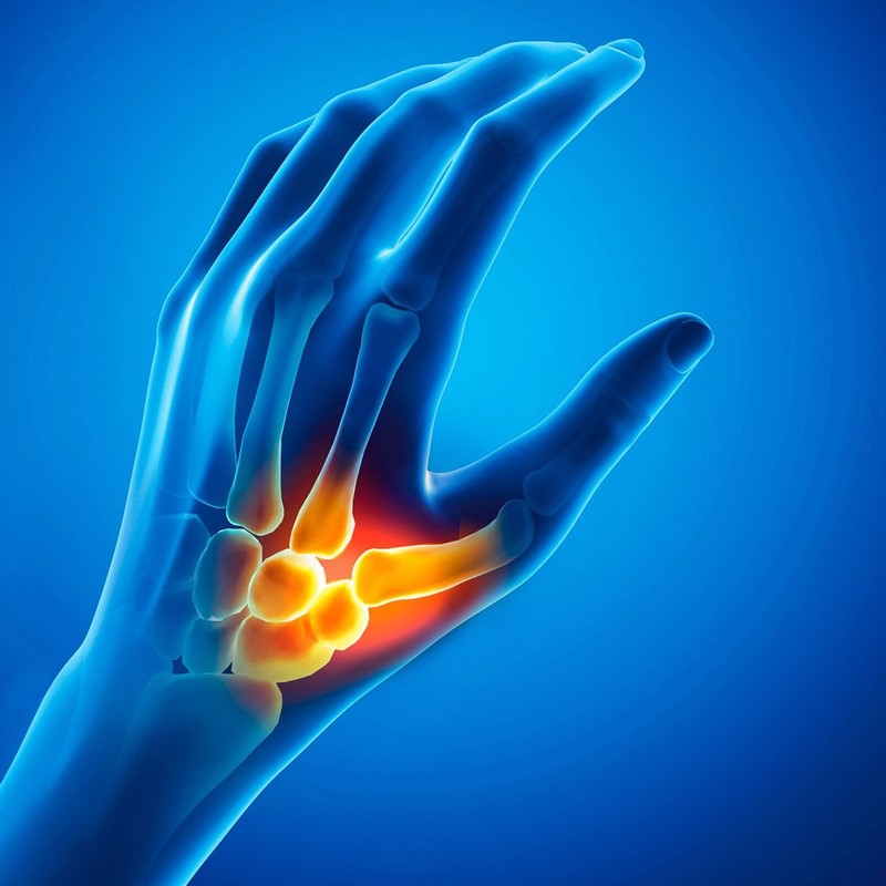 Hallux valgus Korrekturorthese mit Doppelschutz links (S)