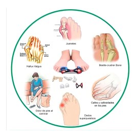 Set 7 Pzas Correctores De Juanete, Protector Paliviar Dolor Color Na Talla Unitalla                                                                   