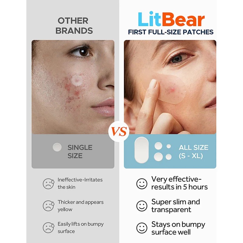 Grandes Parches De Espinilla, Parches De Acné De Litbear Par