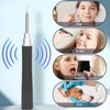 Ear Wax Removal Camera 5MP 4.2mm 70 Degree Viewing 6