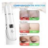 Limpiador Ultrasónico Scrubber Facial Skin Peeling Portatil