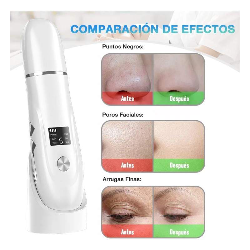 Limpiador Ultrasónico Scrubber Facial Skin Peeling Portatil
