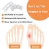 KIYOKI Toe Spacers Toe Separators for Women Men to Correct