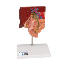 3B Scientific Human Anatomy - Gallstone Model + Free Anatomy App - 3B Smart Anatomy