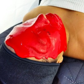 Mascarilla Hidroplástica Vampire Rellenadora Con Poliláctico Todo tipo de piel