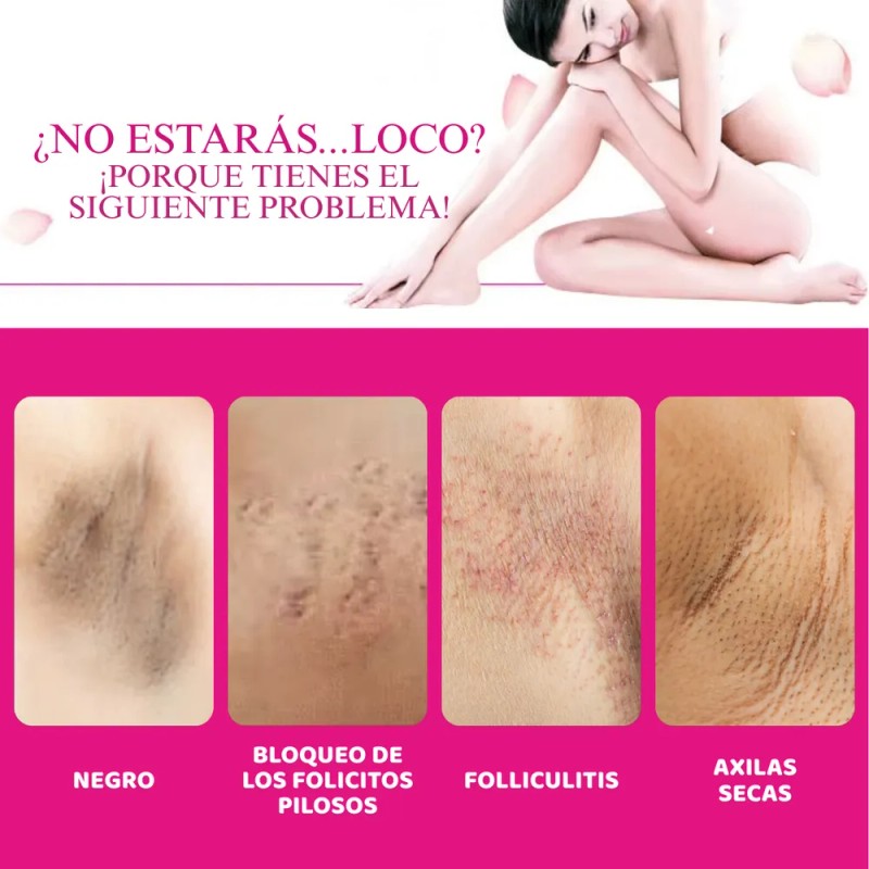 Crema Aclaradora Yogurt Zona Íntima Pezón Manchas Codo Full