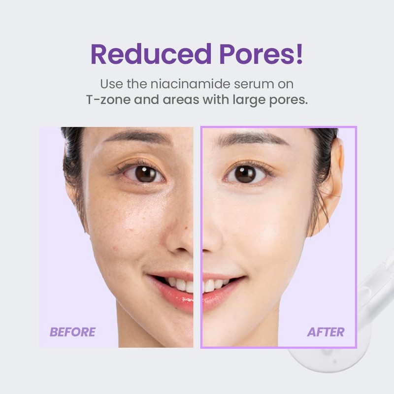 TIRTIR [TIRTIR]Niacinamide 20% Serum 30ml