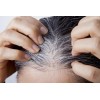 Oscurece Cabello Al Tinte 2 Fases Matiza Reduce Canas Shelo