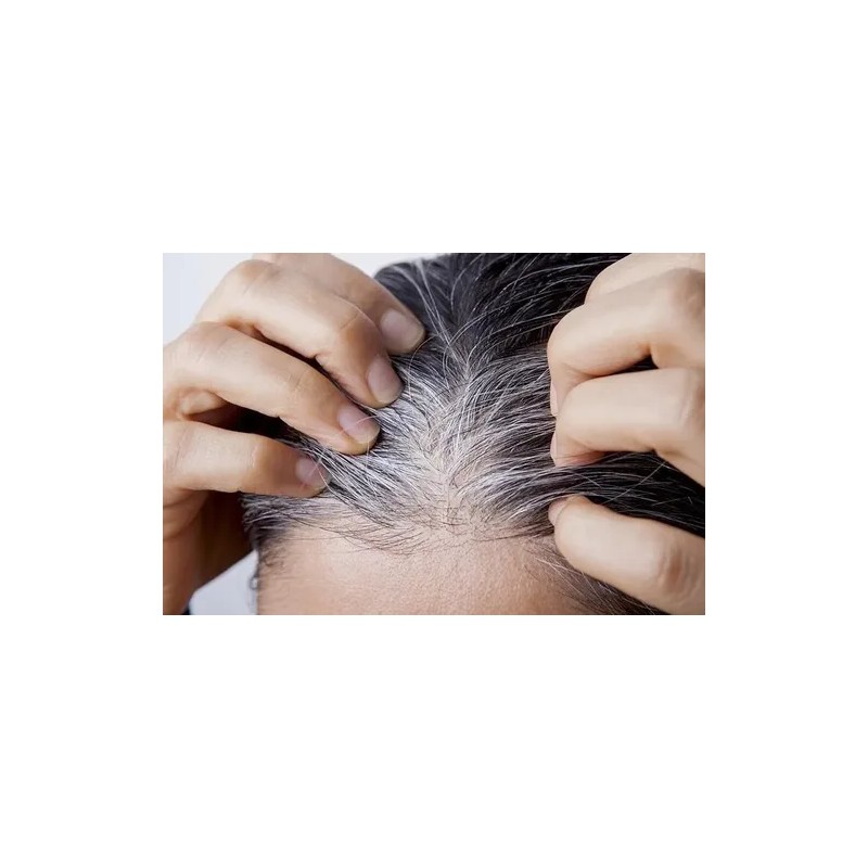 Oscurece Cabello Al Tinte 2 Fases Matiza Reduce Canas Shelo
