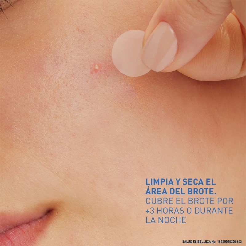 Cerave Parches Control Imperfeccion 22p Piel Tendencia Acné