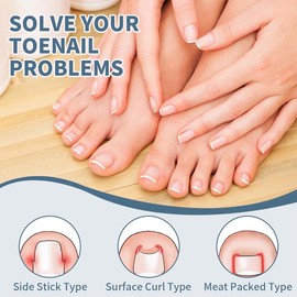 DIFLAX Ingrown Toenail Correction Kit, 50 Pieces Painless Toenail Straightening Strips, Nail Clippers for Strong Toenails, with Toenail Lifter, for Correcting Toenail Ingrown