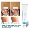 Crema Despigmentante Manchas Melasma Cicatrices Paño Y Acne