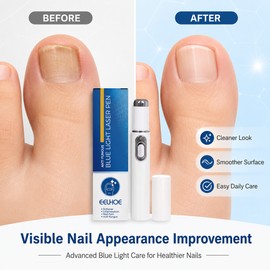 Nail Care Pen for Toenail Appearance – Portable Beauty Tool for Daily Nail Repair & Home Grooming
