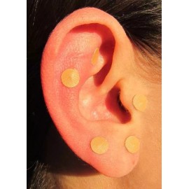 rodmex01 3 Millares De Balines Para Auriculoterapia (baño De Oro)