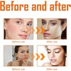 Tónico Facial de Cúrcuma Natural 2Pcs 100ml Suero Aclarante y